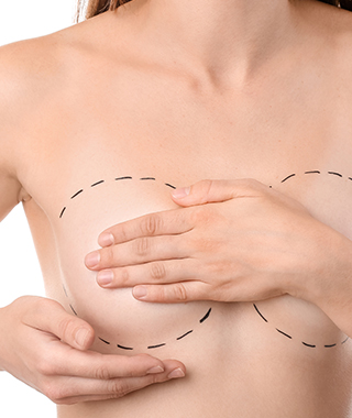 İMPLANTLA MEME BÜYÜTME